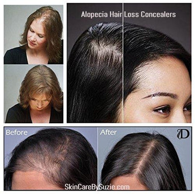 Hair Loss Concealer and Hair Building Fibers For Alopecia and Baldness - Skin Care By Suzie