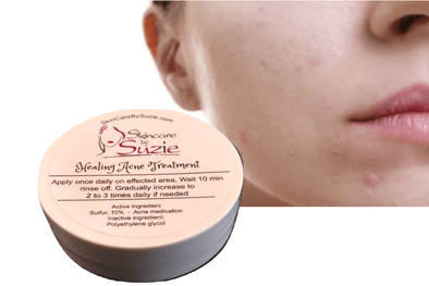 New ! Healing Acne Treatment by Skin Care By Suzie - Skin Care By Suzie