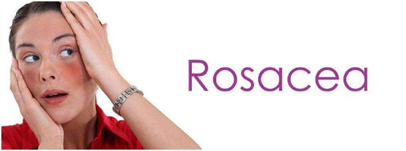Rosacea Skin