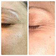 BENECELL EFG 100 Serum: Powerful Anti-Aging, Firming, Radiance-Boosting EGF Skin Repair
