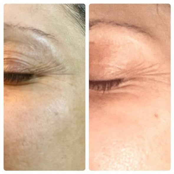 BENECELL EFG 100 Serum: Powerful Anti-Aging, Firming, Radiance-Boosting EGF Skin Repair