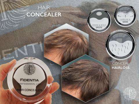Fidentia Concealer to Combat Hair Loss for Men & Women - Hair Loss -Skin Care By Suzie, free shipping & rewards (270529986589)